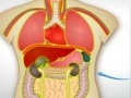 2 transplantation d'organes pour jouer en ligne